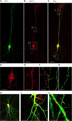 Chemogenetic Silencing of Differentiating Cortical Neurons Impairs Dendritic and Axonal Growth